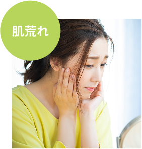 肌荒れ